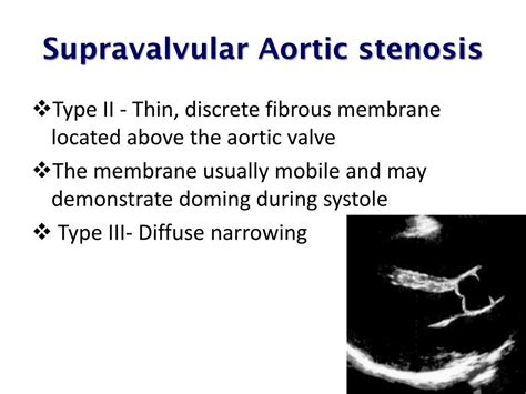 Ppt Echocardiographic Assessment Of Aortic Valve Stenosis Powerpoint