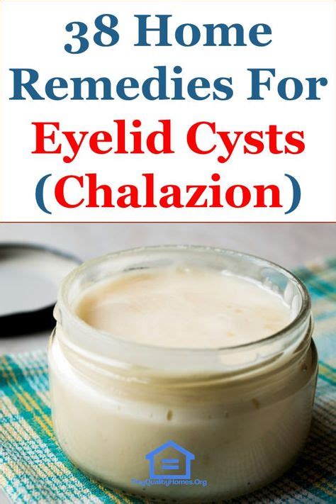 7 Best Eye Cyst Ideas Cysts Eye Cyst Stye Treatment