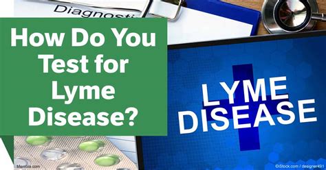 How Do You Test For Lyme Disease
