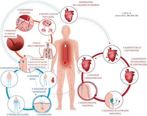 El Calor Excesivo Perjudica Seriamente La Salud Salud Con Lupa