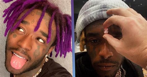 rapper lil uzi vert gets a pink diamond inserted into his head for 24 000 000 sorry if posted