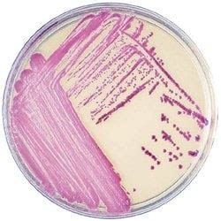 BD BBL Prepared Plated Media CHROMagar MRSA II Microbiological Media