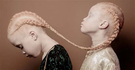 Albino Twins From Brazil Are Challenging The Fashion Industry With