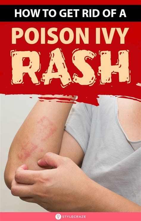 How To Get Rid Of A Poison Ivy Rash Here Are Some Of The Best And Most