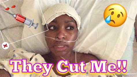 My Open Myomectomy Surgery Part 2 Allthingslatoya Latoya Schmitz Youtube