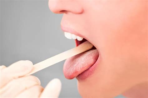 bumps on roof of your mouth 11 potential causes