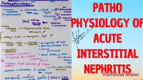 Pathophysiology Of Acute Interstitial Nephritis Medicine With Dr