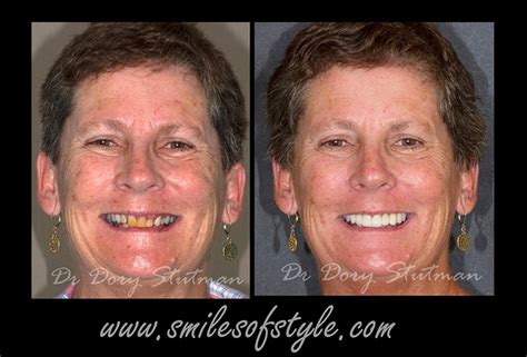 Featured Smiles South Shore Dental Care