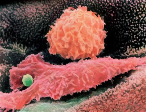 Macrophages In Lung Photograph By Dr Arnold Brodyscience Photo Library