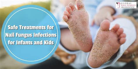 Safe Treatments For Nail Fungus Infections For Infants And Kids Gnfo