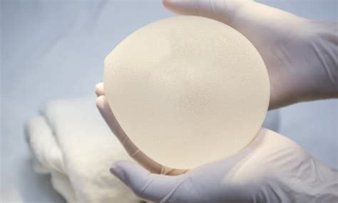 Breast Implants Tied To Rare Cancer Can Remain On The Market Us