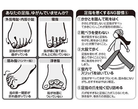 表示されているのは、検索条件に一致する求人広告です。 求職者が無料で indeed のサービスを利用できるように、これらの採用企業から indeed に掲載料が支. あなたの足指は大丈夫？日本人が起こしやすい足指の変形症状 ...