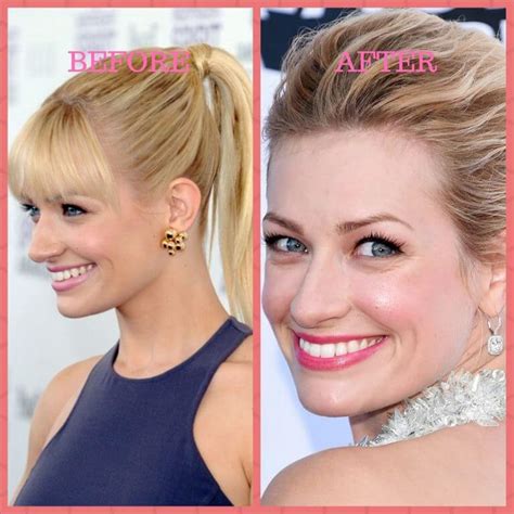 Beth Behrs Plastic Surgery Photos Before And After Surgery4