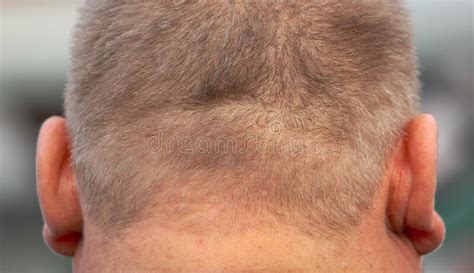 Nape And Ears Of A Fat Man Stock Image Image Of Nape 180955183
