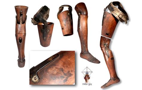 33 Best Early Prosthetic Limbs Images On Pinterest Medical History