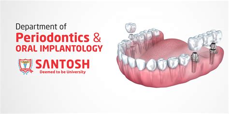 Department Of Periodontics And Oral Implantology