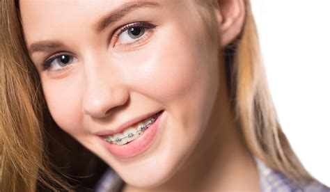 Adult Braces 8 Myths About Getting Adult Braces Molson Park Dental