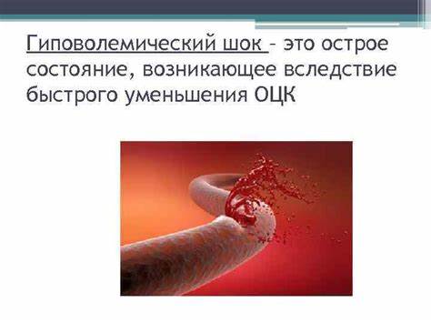 Диета 5 острое состояние Гиповолемический шок Гиповолемический шок это острое Гиповолемический шок Гиповолемический шок это острое Диета 5 острое состояние
