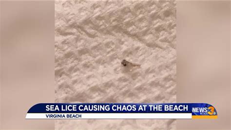sea lice stinging virginia beach swimmers