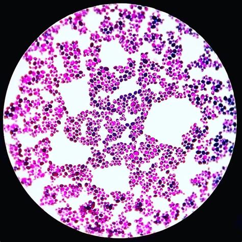 Candida Albicans Gram Stain Candida Albicans Candida Microbiology