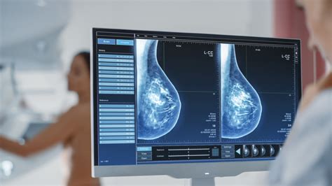 Weve Got The Answers To All Your Burning Mammogram Questions