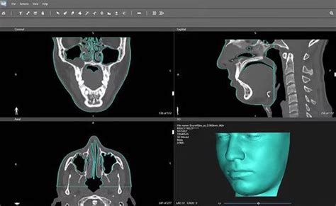3d systems enters the radiation oncology market with new vsp bolus 3d printing offering 3d