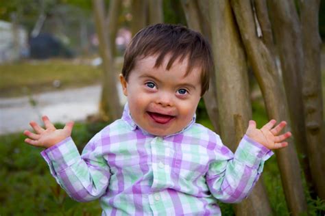 Ds is characterized by a variety of dysmorphic features, congenital malformations, and. Celebrate World Down Syndrome Day with us March 21st ...