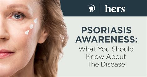 What You Should Know About Psoriasis 5 Important Facts