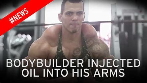 Bodybuilder With 23 Inch Biceps Risks Life By Injecting Oil Into His Muscles To Look Like The