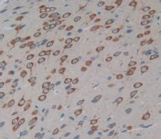 Высокая клиническая чувствительность и специфичность. HRP-Linked Guinea pig Anti-Rabbit IgG Polyclonal Antibody ...