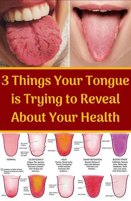 The Amazing Secrets That Your Tongue Can Reveal About Your Health