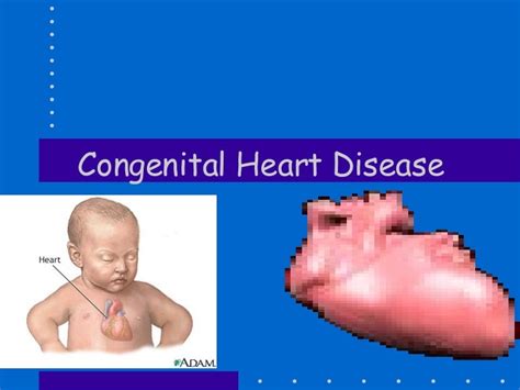 Congenital Heart Disease