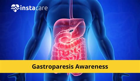 Gastroparesis Symptoms Causes Complications And Diagnosis