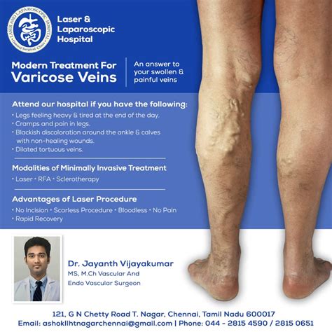 Varicose Veins Are The Gnarled Enlarged Veins Most Commonly Appearing