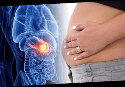 …this means your whole tummy can extend with excess fluid! Bloating stomach causes: Pain, swelling and feeling full ...