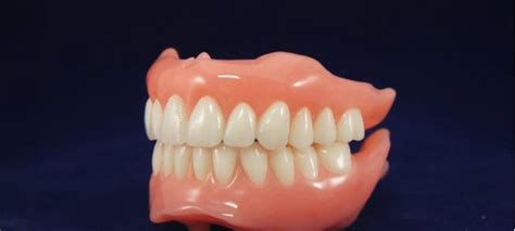 Permanent Soft Denture Liners Alberta Denture Partial Dentures Soft