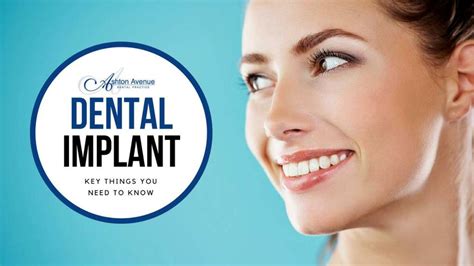 Ppt Key Things You Need To Know About Dental Implants Powerpoint