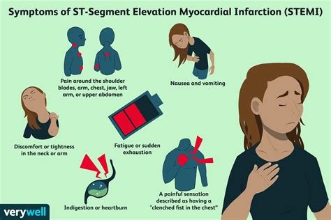 St Elevation Myocardial Infarction