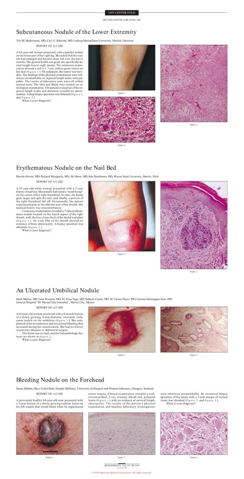 Subcutaneous Skin Nodules