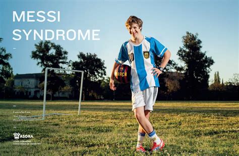 Asdra Messi Syndrome Down Syndrome Messi Syndrome