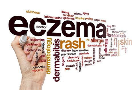 Can Stress Cause Eczema Healthier Steps