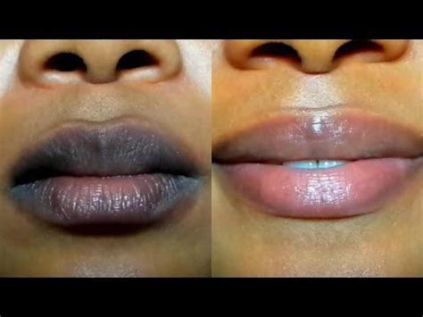 dark lips semi permanent bleaching solution for pinker lips etsy