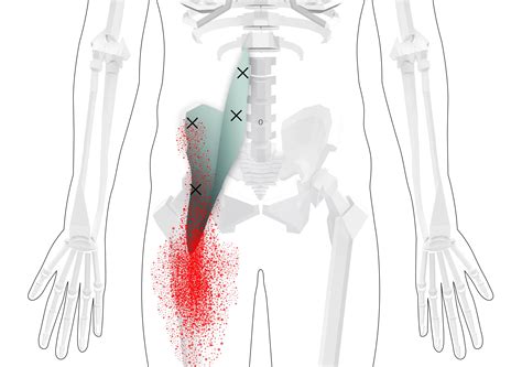 Iliocostalis Lumborum Trigger Points Overview And Self Treatment