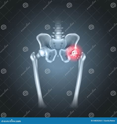 Human Pelvis Hip Pain Stock Vector Illustration Of Healthy 54835263