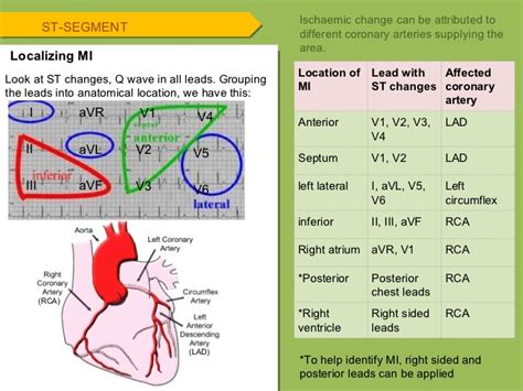 Ecg changes during myocardial infarction (mi). ECG
