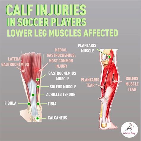 Do You Keep Pulling Your Calf Learn More About Calf Muscle