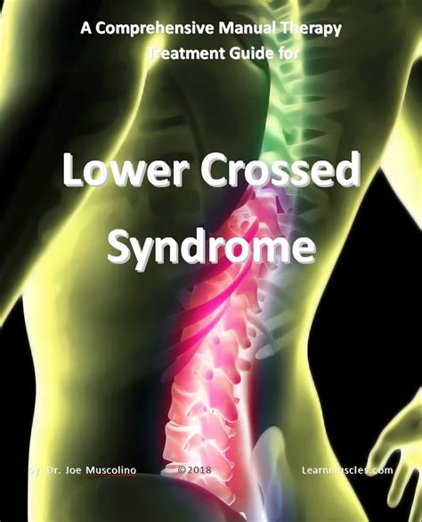 A Comprehensive Treatment Guide For Lower Crossed Syndrome Learn Muscles