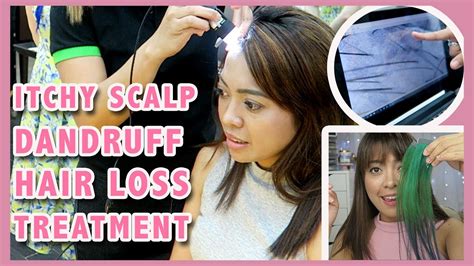Having an itchy scalp leads to hair loss often because of the underlying condition. TREATMENT FOR ITCHY SCALP, DANDRUFF, AND HAIR LOSS AT ...