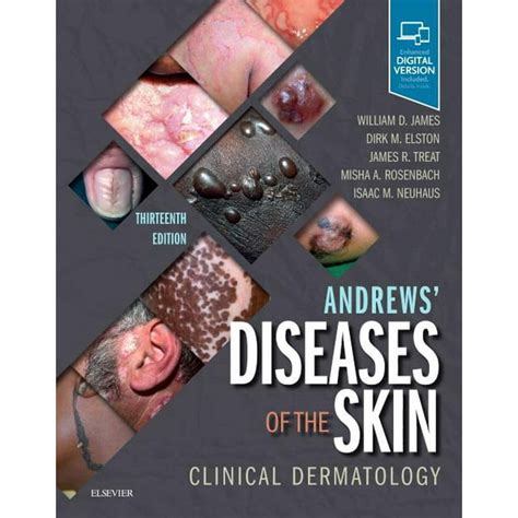 Andrews Diseases Of The Skin Clinical Dermatology Edition 13