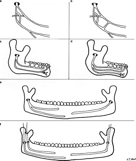 Summary Diagram Indicating Variant Branching Patterns Of The Inferior